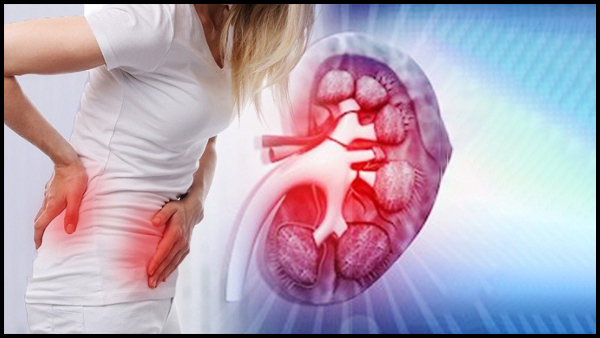 Kidney Cancer Symptoms Never Ignore These Signs Of Kidney Cancer