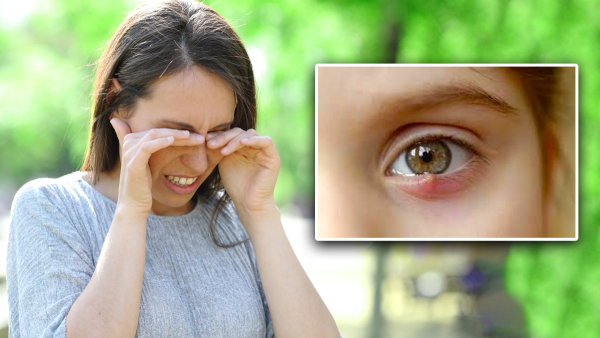 Vitamin A Deficiency Symptoms in Tamil Vitamin A Deficiency Symptoms in Tamil