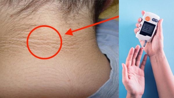 Diabetes Symptoms In Tamil Top 5 Signs That Indicate Blood Sugar Imbalance