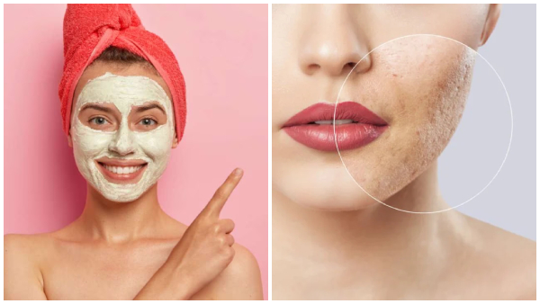 Skin Care Tips Top 5 DIY Face Packs To Close Your Open Pores In Tamil
