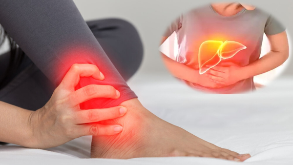 World Hepatitis Day 2024 Top 7 Warning Symptoms Of Hepatitis In Legs And Feet At Night