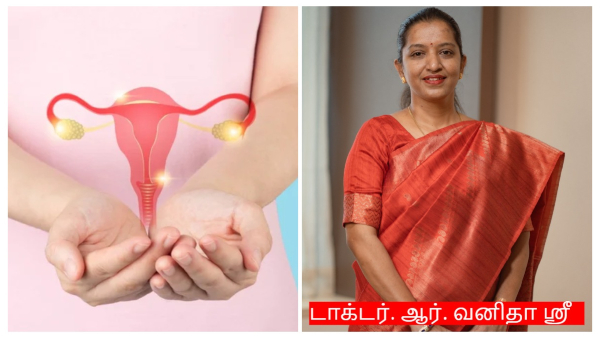 Exclusive Doctor Shares About What is Polycystic Ovary Syndrome Symptoms And Causes