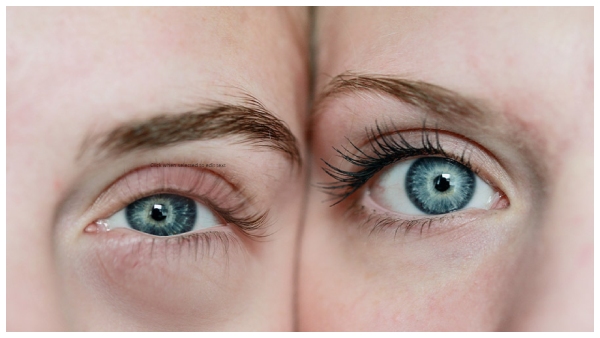 what is the reason for swelling eyes while wake up in the morning