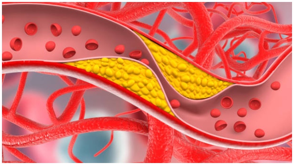 Eat these Soaked Foods On An Empty Stomach In the Morning To Reduce high Bad Cholesterol