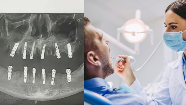 china-man-dead-by-heart-attack-after-his-23-teeth-removed-in-one-day