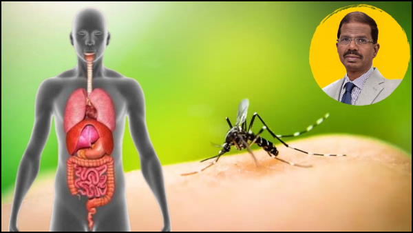 Exclusive Interview With Dr Swamikannu About How Dengue Damage Every Major Parts Of The Body