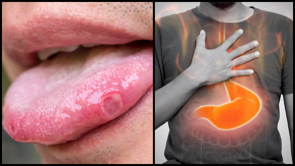 Cancer Symptoms In Men Crucial Signs Of Cancer Men Should Not Ignore