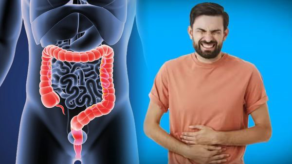 Cancer Types of Cancers That Are Rise In Younger Adults