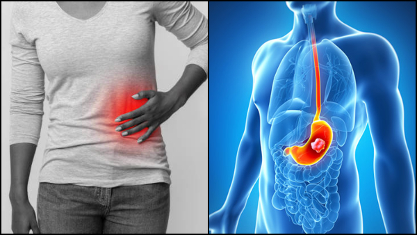 Stomach Cancer Symptoms Early Warning Signs Of Stomach Cancer You Should Know