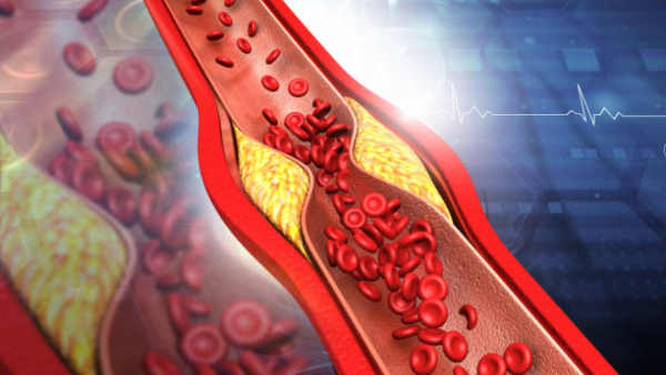 Heart Healthy Cooking Oils Top 5 Healthy Oils for People With Cholesterol