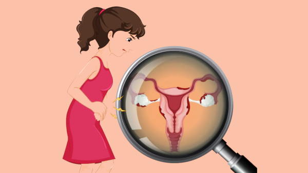 World Ovarian Cancer Day 2025 Ovarian Cancer Signs And How Acupuncture Helps Ovarian Cancer Patients