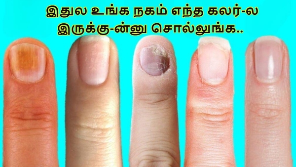 Doctor Reveals What Different Nail Color Says About Your Health