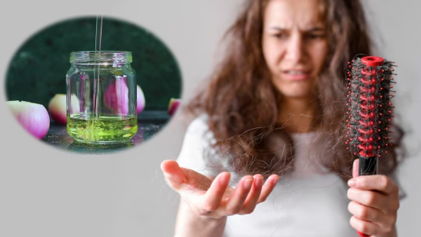 Hair Care Tips DIY Homemade Onion Hair Oil To Reduce Hair Fall In 7 Days Hair Care Tips DIY Homemade Onion Hair Oil To Reduce Hair Fall In 7 Days