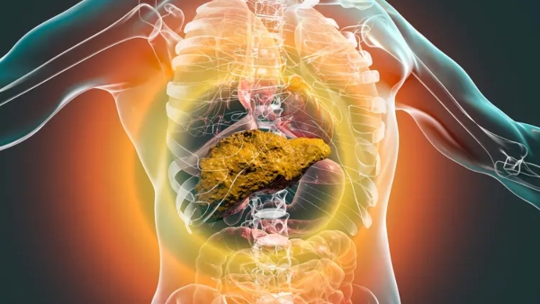 Unhealthy Liver Symptoms Gastroenterologist Shares Top 5 Early Warning Signs Of Liver Problems