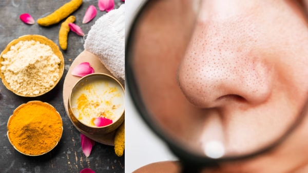 Top 5 DIY Face Scrubs To Get Rid Of Blackheads At Home Top 5 DIY Face Scrubs To Get Rid Of Blackheads At Home