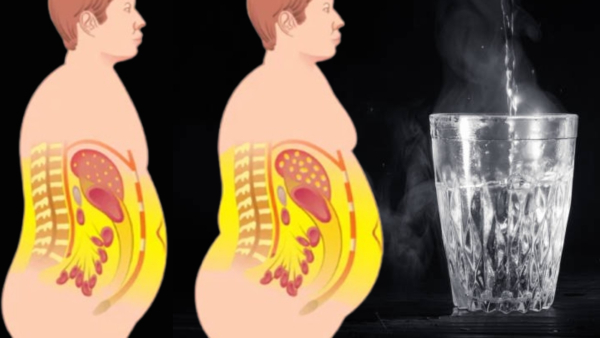 Does Really Drinking Hot Water Helps To Burn Fat - Expert Opinion