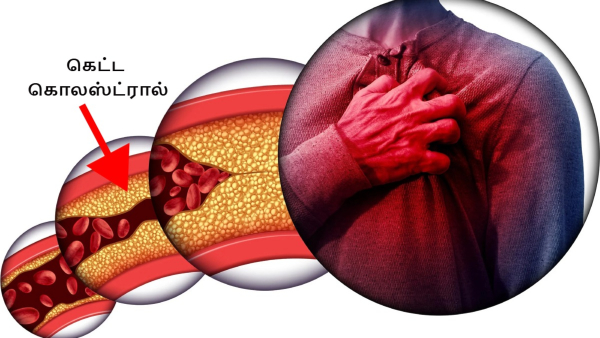 Top 5 Red Drinks To Reduce LDL Cholesterol Levels Naturally