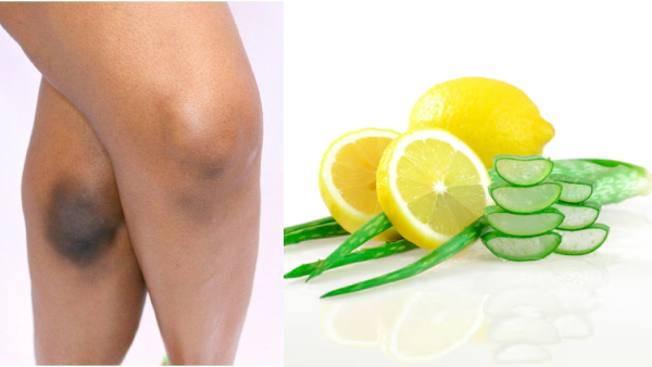 Skin Care Tips Top 6 Home Remedies To Remove Dark Knees