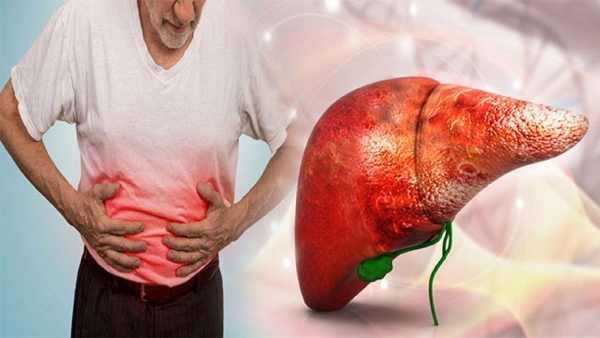 Top 4 Skin Changes That Could Indicate Liver Problem According To US Liver Doctor