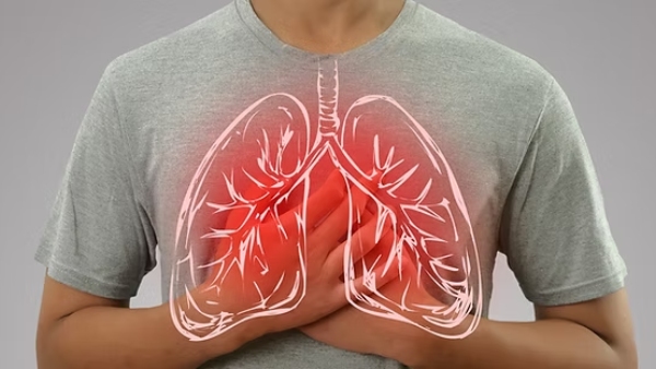 World Lung Cancer Day 2025 Doctor Lists Top 5 Warning Symptoms Of Lung Cancer World Lung Cancer Day 2025 Doctor Lists Top 5 Warning Symptoms Of Lung Cancer