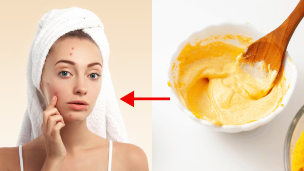 Skin Care Tips Top 5 Acne Fighting Face Masks To Reduce Acne Breakouts