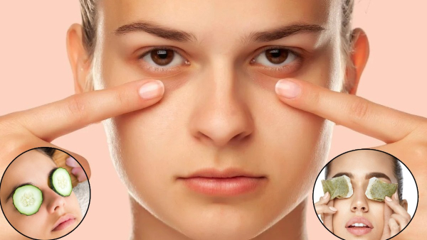 Skin Care Tips How to Remove Dark Circles Naturally