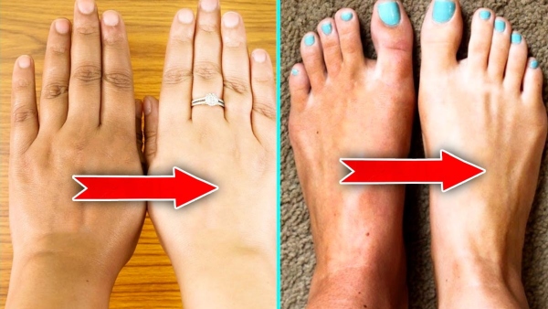 Skin Care Tips Top 5 DIY Home Remedies To De-Tan Feet And Hands