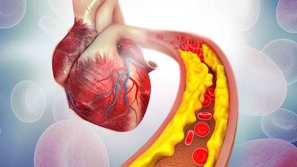 Top 7 Signs of Blocked Arteries At Night You Should Never Ignore Top 7 Signs of Blocked Arteries At Night You Should Never Ignore