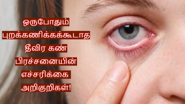 World Sight Day 2025 Ophthalmologist Lists Top 5 Warning Signs of Serious Eye Problems