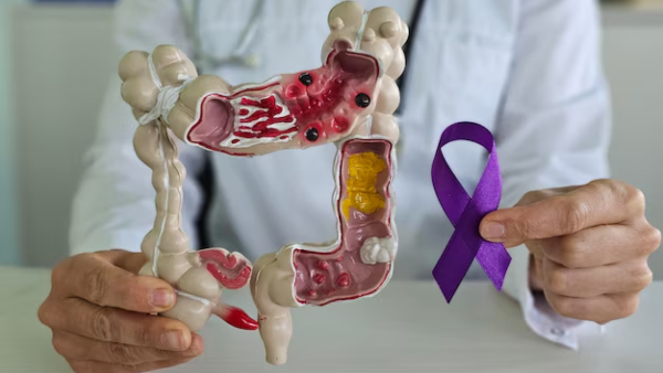 US Gastroenterologist Shares Top 4 Fruits That Reduce The Risk Of Colon Cancer