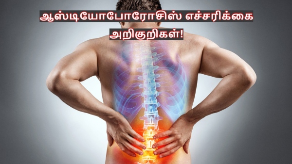 World Osteoporosis Day 2025 Doctor Explains What Is Osteoporosis Causes Symptoms Foods To Eat