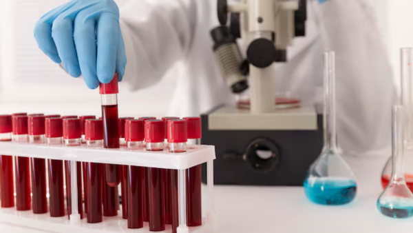 World Pneumonia Day 2025 Doctor Explains About How Pneumonia Silently Collapses Your Lungs