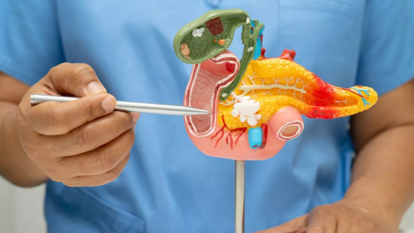 World Pancreatic Cancer Day 2025 Doctor Lists Warning Signs of Pancreatic Cancer