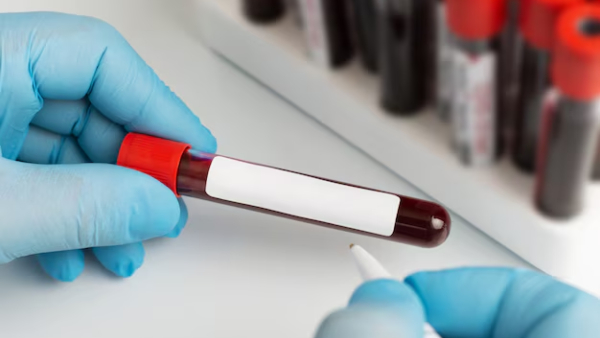 World Pancreatic Cancer Day 2025 Doctor Lists Warning Signs of Pancreatic Cancer