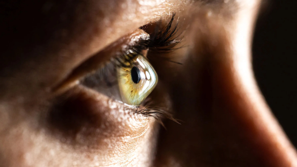 World Keratoconus Day 2025 All You Need To Know About Keratoconus Disease