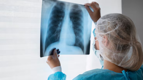 World Pneumonia Day 2025 Doctor Explains About How Pneumonia Silently Collapses Your Lungs