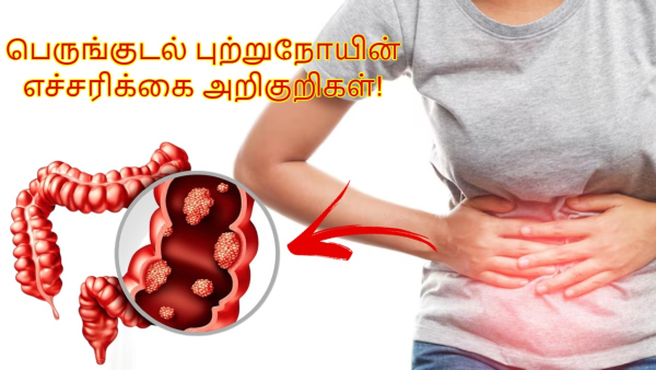 Colon Cancer Signs Harvard Doctor Shares 5 Warning Symptoms You Shouldn t Ignore Colon Cancer Signs Harvard Doctor Shares 5 Warning Symptoms You Shouldn t Ignore