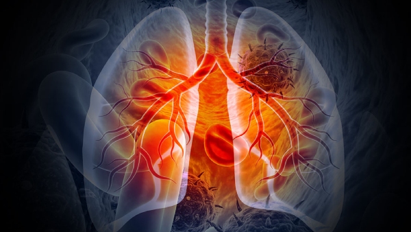 Lung Cancer Symptoms Top 5 Skin Problems That Could Signal Lung Cancer