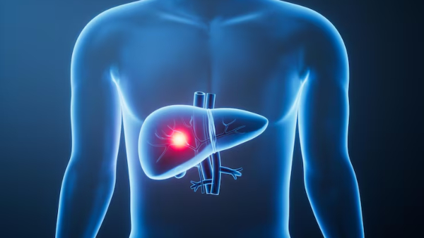 Things To Know About The Link Between Dark Spots And The Liver