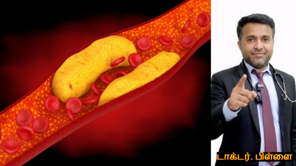 Doctor Shares A Diet Chart to Reduce Bad Cholesterol Without Medication