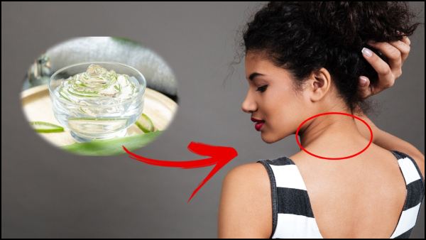 Skin Care Tips Top 5 Home Remedies To Cure Neck Pigmentation