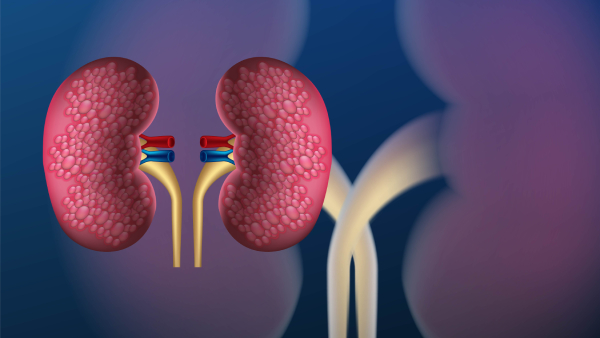 Kidney Health Five Best Foods That Support Kidney Function and Detox