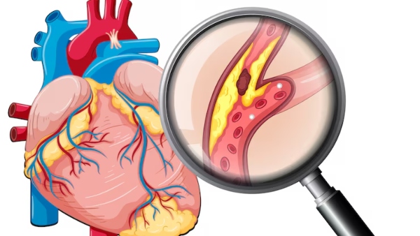 Homemade Syrup To Cure Heart Blockage In Tamil
