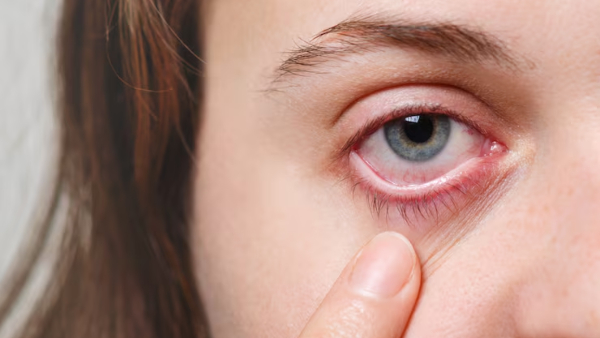 Ophthalmologist Shares How To Prevent Eye Related Issues During The Summer Ophthalmologist Shares How To Prevent Eye Related Issues During The Summer