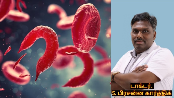 World Sickle Cell Day 2026 Doctor Explains What Is Sickle Cell Disease Symptoms and Treatment