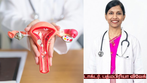 Ovarian Cancer Awareness Month Doctor Explains Symptoms Causes amp amp Prevention Ovarian Cancer Awareness Month Doctor Explains Symptoms Causes amp amp Prevention