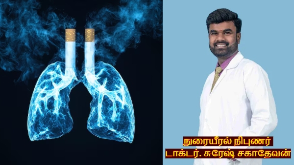 World Lung Day 2026 How Long Does It Take For Lungs To Clear Cigarette Smoke Pulmonologist Explains World Lung Day 2026 How Long Does It Take For Lungs To Clear Cigarette Smoke Pulmonologist Explains
