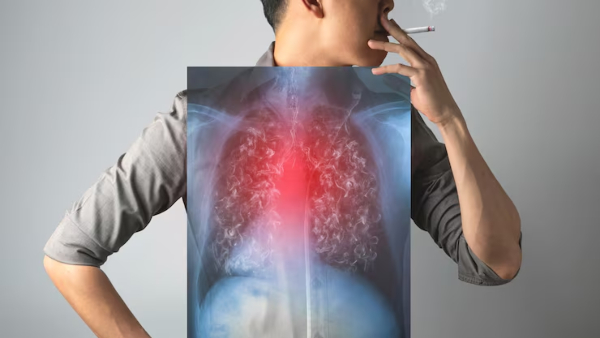 World Lung Day 2026 How Long Does It Take For Lungs To Clear Cigarette Smoke Pulmonologist Explains World Lung Day 2026 How Long Does It Take For Lungs To Clear Cigarette Smoke Pulmonologist Explains