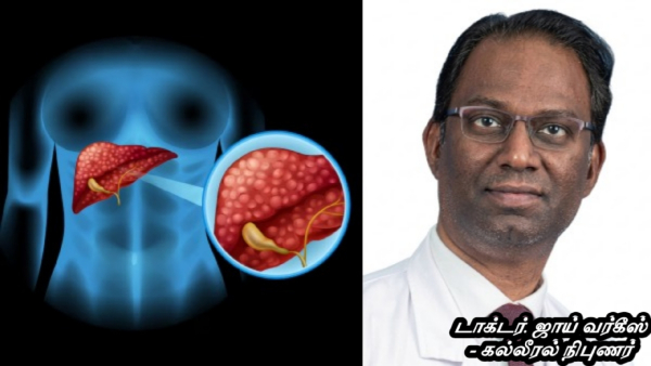 Liver Cancer Awareness Month - Fatty Liver to Liver Cancer How Serious Is the Risk Hepatologist Explains