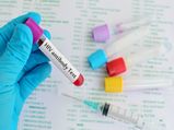 తొలిసారిగా HIV నుండి పూర్తిగా కోలుకున్న మహిళ.. స్టెమ్ సెల్ మార్పిడితో ఈ మిరాకిల్.. 